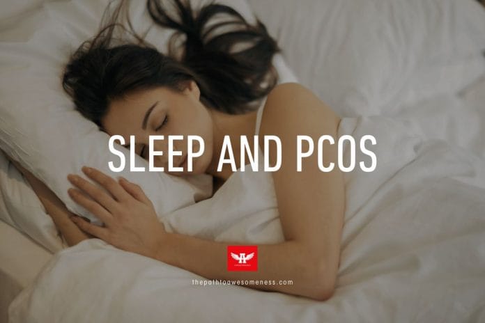 Sleep and PCOS Sleep and PCOS