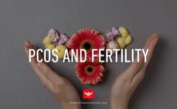 PCOS and Fertility