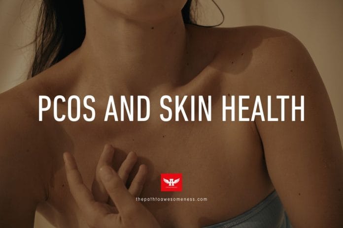 PCOS and Skin Health